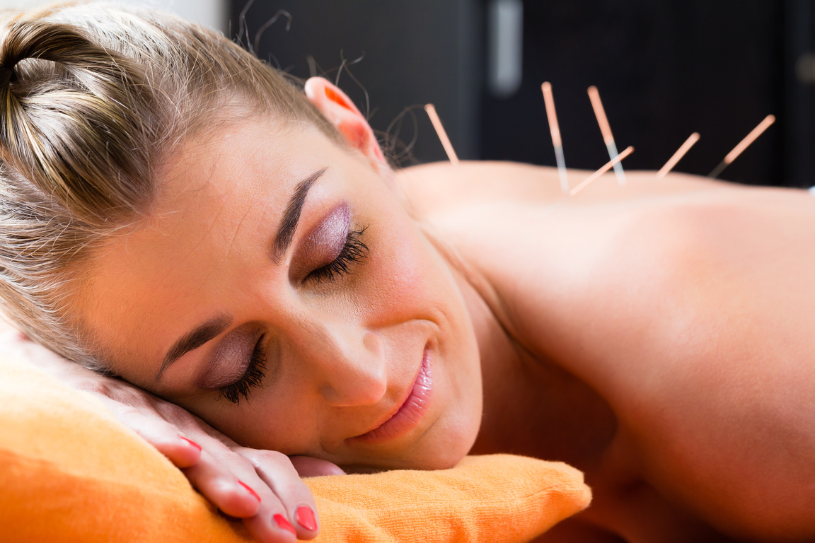 Woman at Acupuncture Needles 
